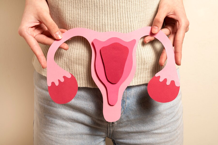 pcos hormonal page